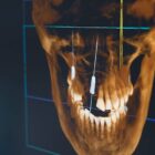 x-ray at Beyond Dental Care