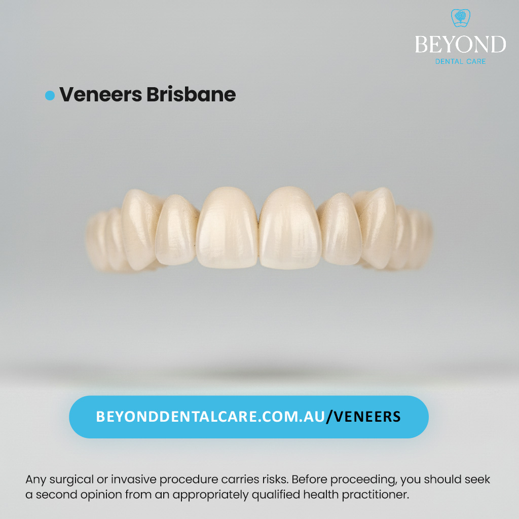 Veneers Brisbane