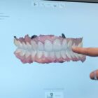 3D Smile Design Scan on a Computer