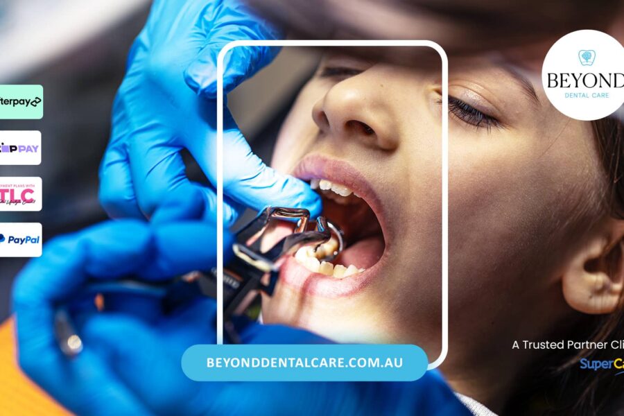 Tooth Extraction for Patients on Blood Thinners