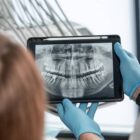 panoramic tomography of patient teeth at Beyond Dental Care