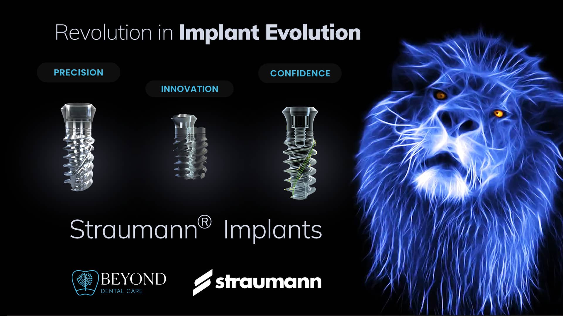 A New Era of Smile Confidence with Straumann® Implants