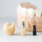 Restorative Dentistry concept of an artificial tooth dental crown and implant