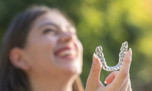 Custom-made clear plastic aligners for gradual teeth straightening