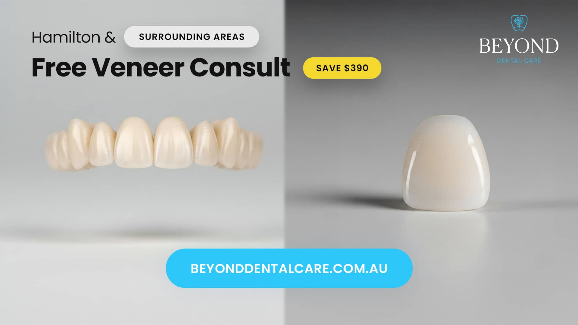 Free Veneer Consult Hamilton