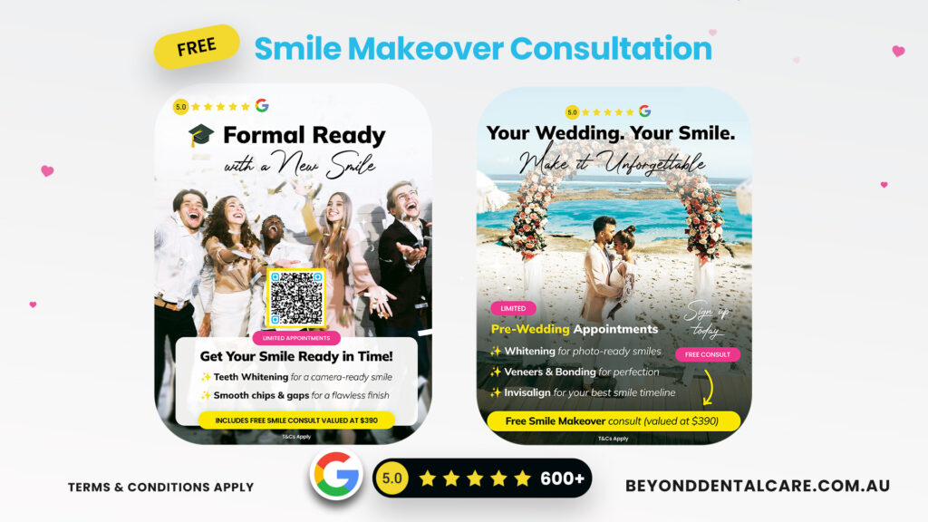 Free Smile Makeover Consultation Wedding & Formal Theme 2025