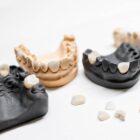 Cosmetic dentistry concept of a artificial jaw mockup with veneers
