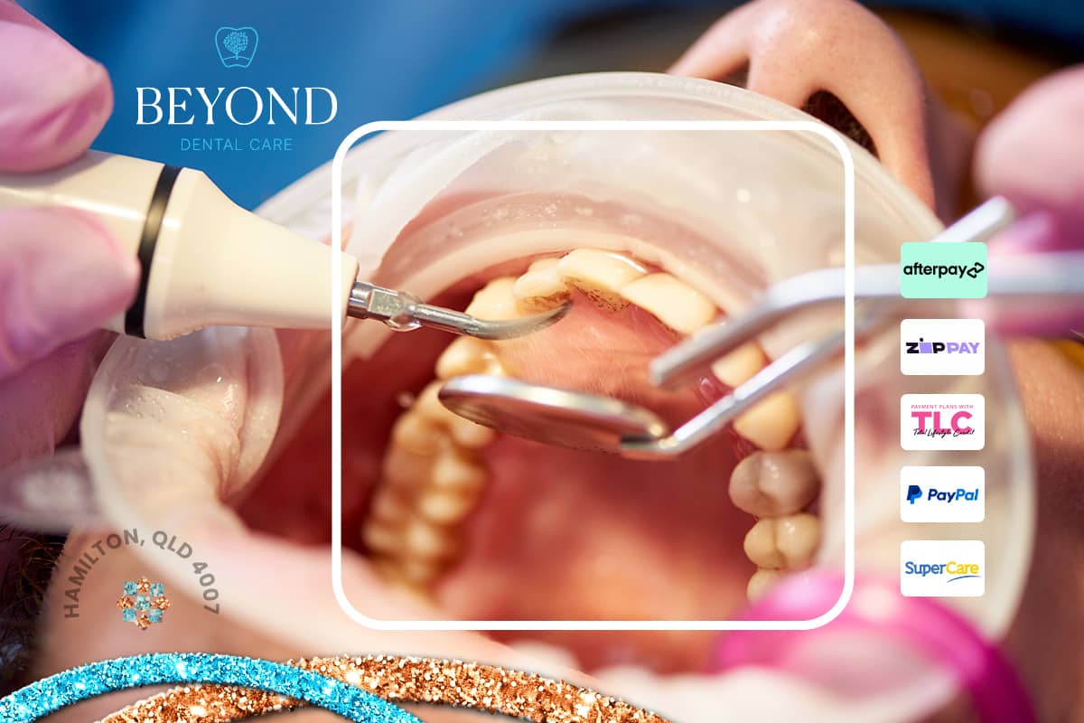 Urgent evaluation for persistent bad oral taste or smell caused by dental infection