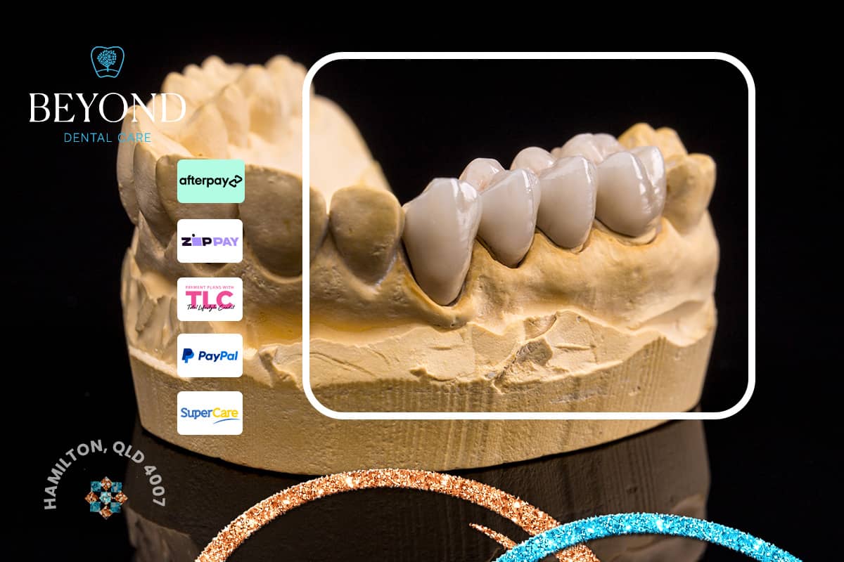 Dental emergency care for fractured bridges or prosthetic appliances affecting comfort or function