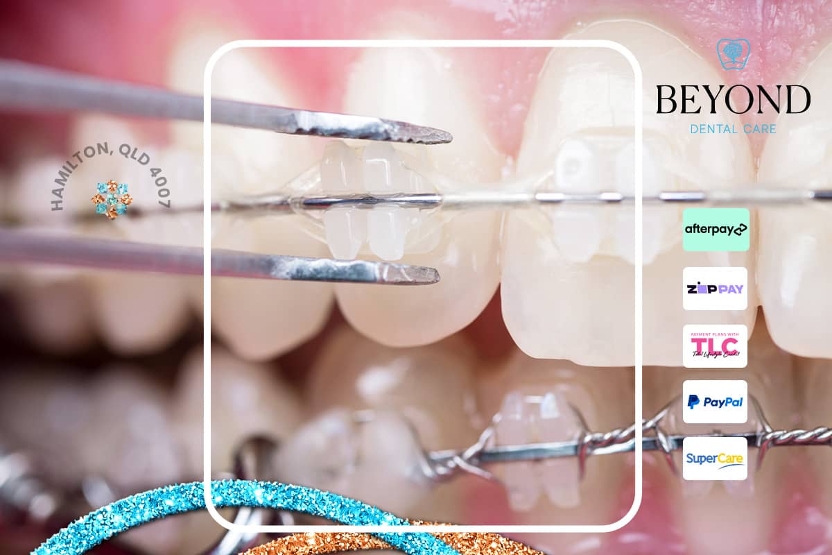 Orthodontic emergency treatment for broken wires causing soft tissue injury