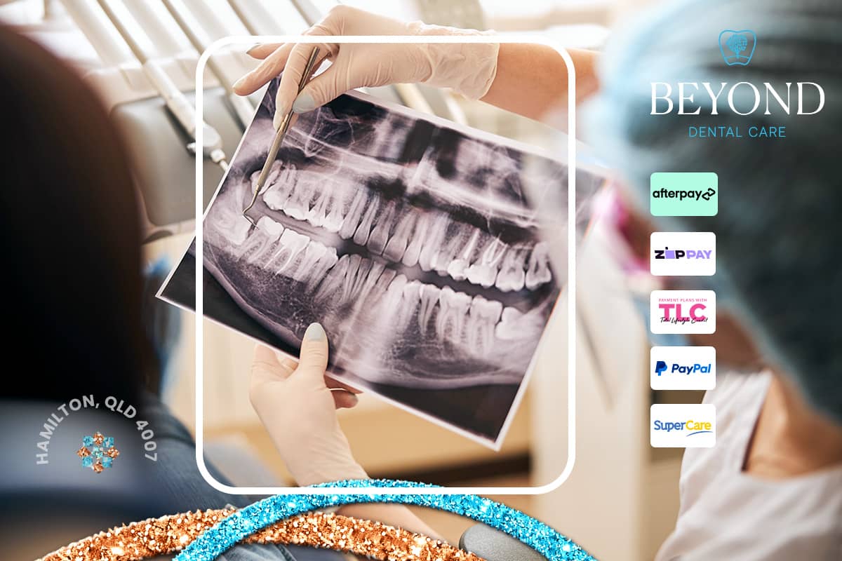 Emergency dental care for cracked enamel or cracked tooth root evaluation and treatment