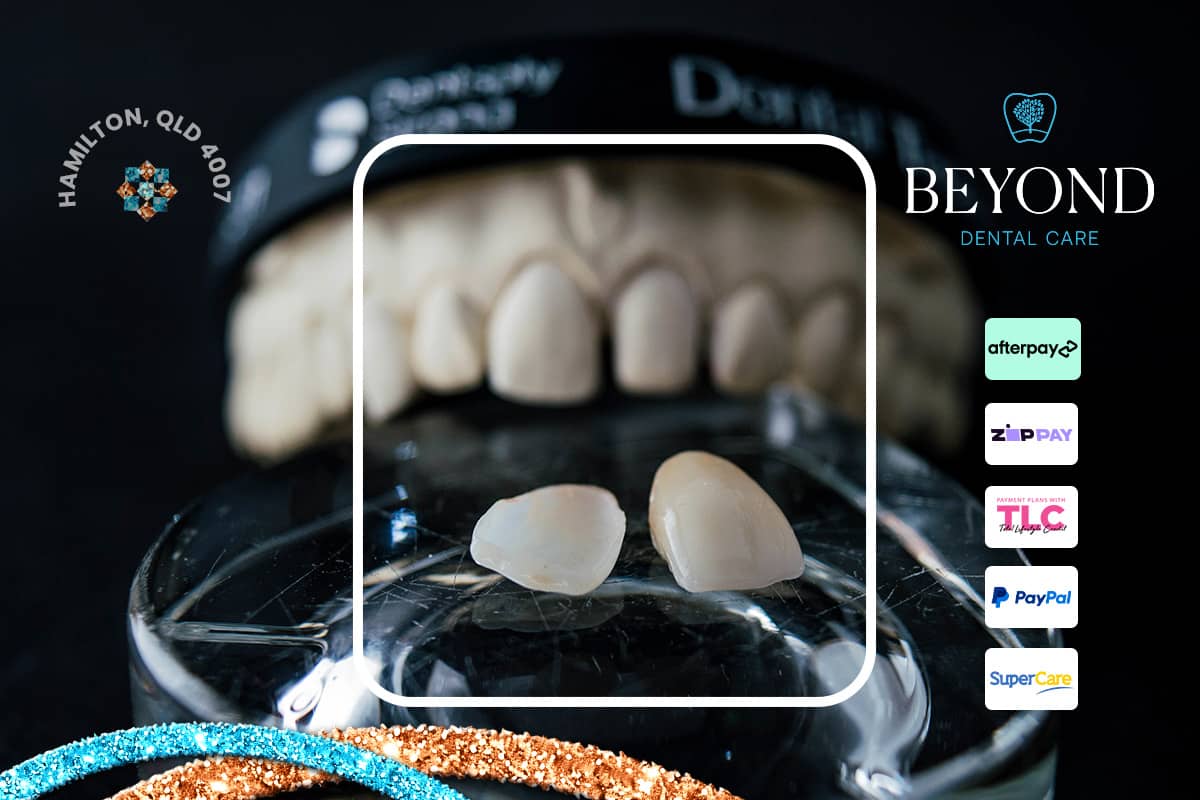 Step-by-step guide and treatment for knocked-out permanent tooth (avulsion)