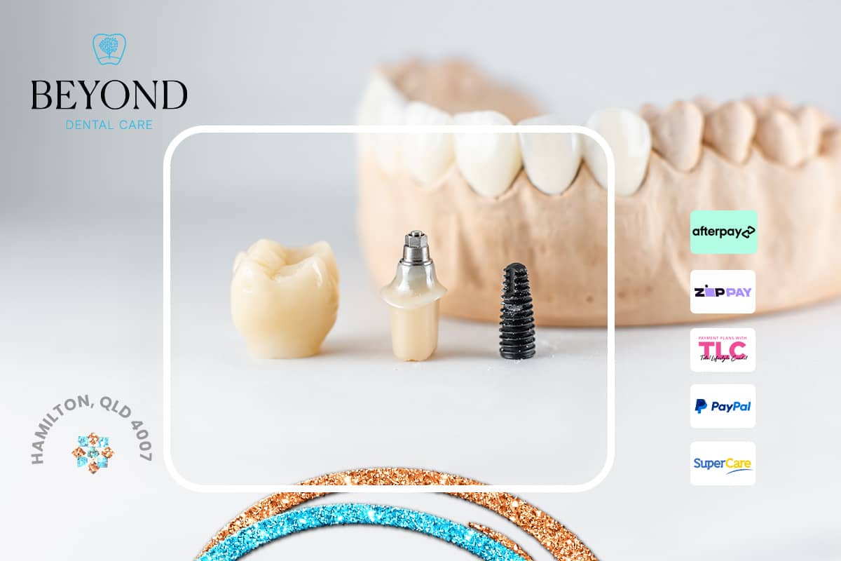 Emergency dental evaluation and tightening of loose dental implant abutments