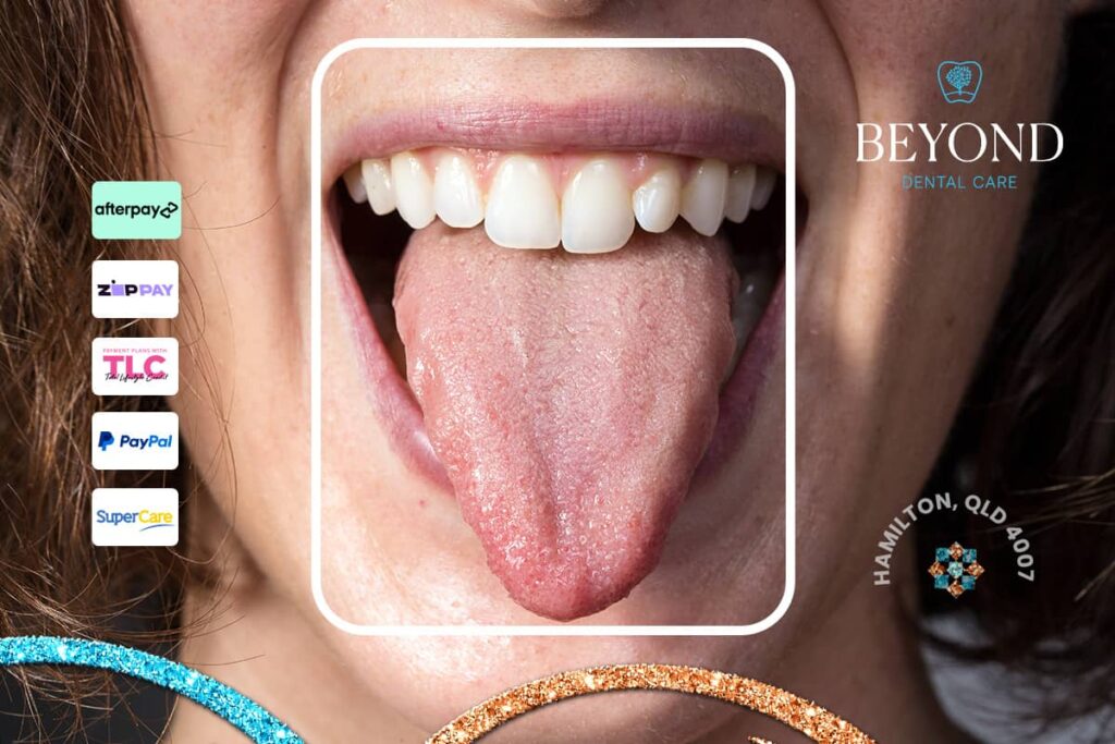 Emergency care instructions and professional treatment for tongue punctures caused by falls or biting accidents