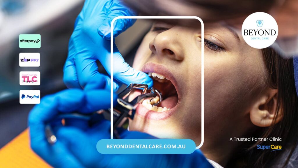 Tooth Extraction for Patients on Blood Thinners
