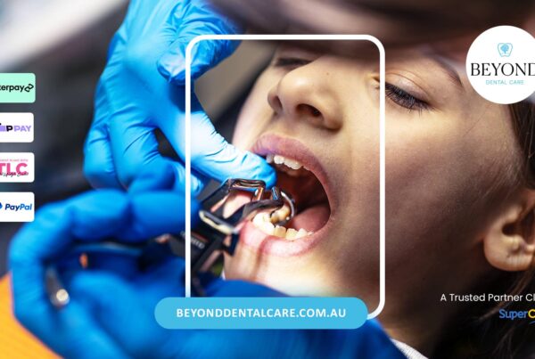 Tooth Extraction for Patients on Blood Thinners