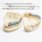 dental prosthesis