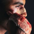 preview Facial Cuts from Accidents Involving the Mouth Emergency Treatment Card