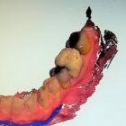 preview Gum Pain Due to Inflammation Emergency Treatment Card