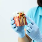 preview Infected Root Canal Emergency Treatment Card