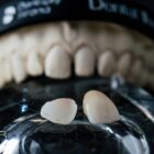 preview Knocked-out Permanent Tooth Avulsion Emergency Treatment Card