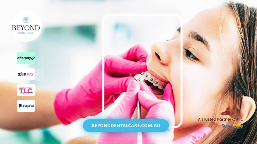 Metal Braces in Brisbane Orthodontics for Complex Dental Corrections
